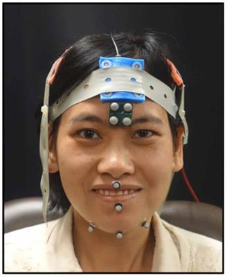 The Effect of Transcranial Direct Current Stimulation on Jaw Motor Function Is Task Dependent: Speech, Syllable Repetition and Chewing